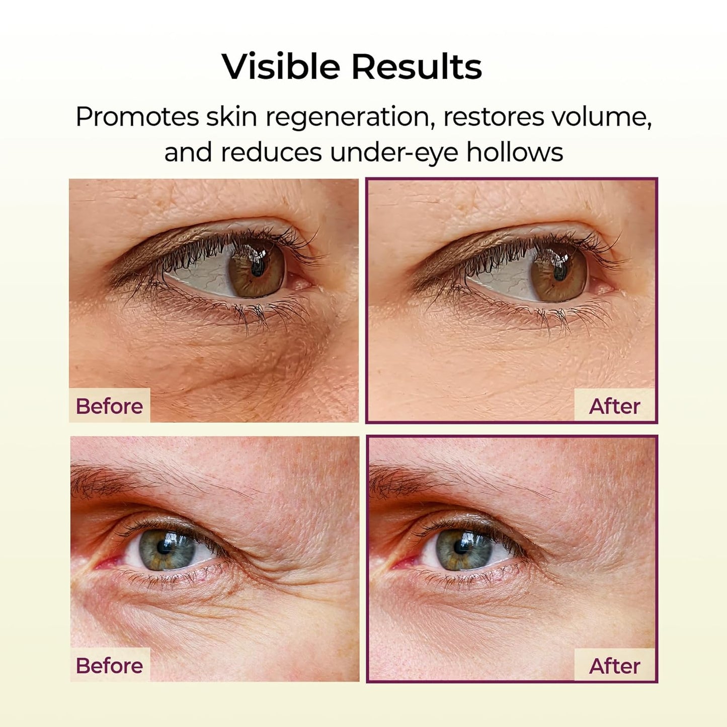 Cemenrete Calcium Balm